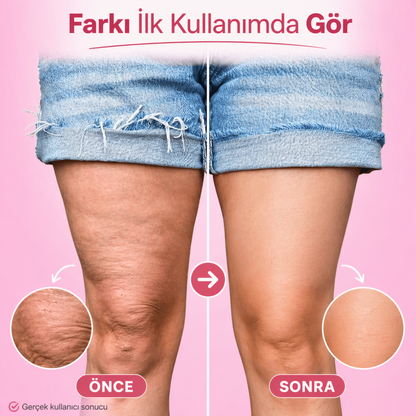 Görünmez Vücut Bantı – Anında Daha Pürüzsüz Görünüm (10 adet)